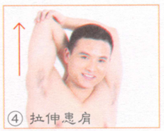肩周炎按摩