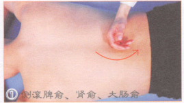 腰肌劳损按摩