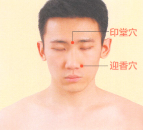鼻炎艾灸