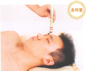 鼻炎艾灸