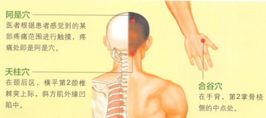 头痛艾灸