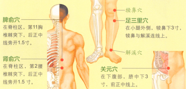 眩晕艾灸