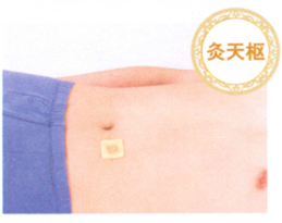 腹泻艾灸