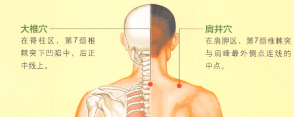 颈椎病艾灸