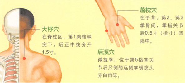 落枕艾灸