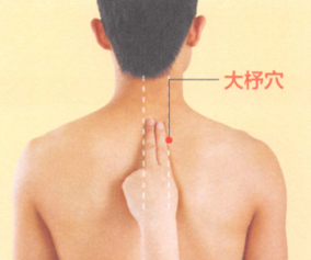 落枕艾灸