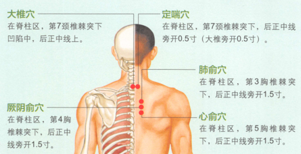 慢性支气管炎艾灸
