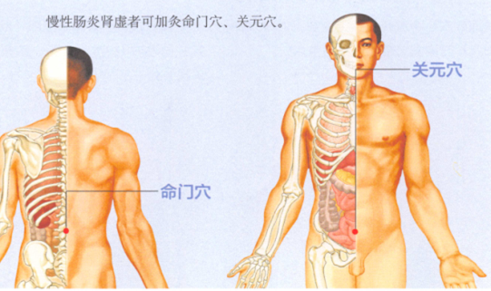 慢性肠炎艾灸