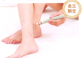 经期头痛艾灸