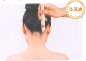经期头痛艾灸