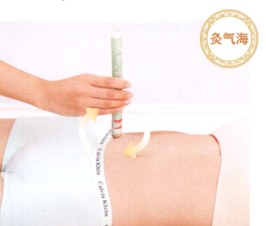 产后腹痛艾灸