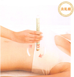 产后缺乳艾灸