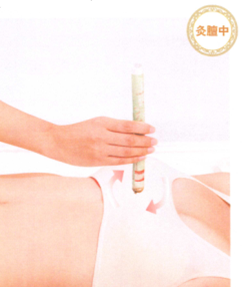 产后缺乳艾灸