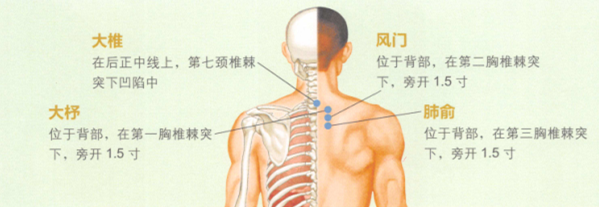 慢性支气管炎艾灸