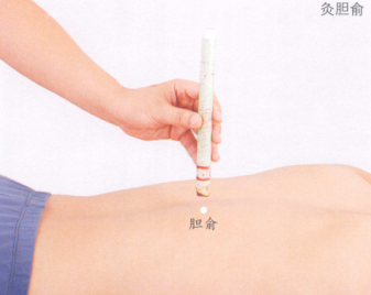 胆石症艾灸