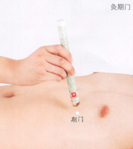 胆石症艾灸