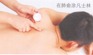 肺结核艾灸