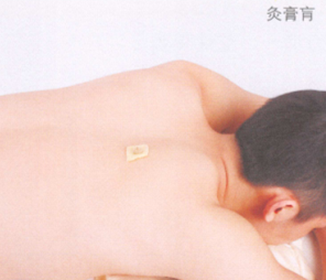 咳嗽艾灸