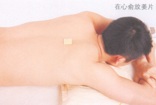 失眠艾灸