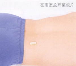 失眠艾灸