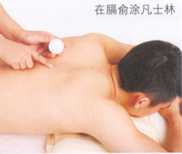 呃逆艾灸