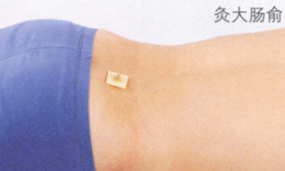 腹泻艾灸