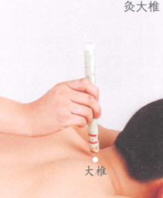 鼻出血艾灸