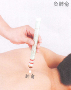 鼻出血艾灸
