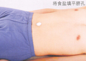 中暑艾灸