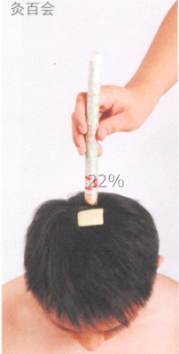 口腔溃疡艾灸