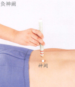 口腔溃疡艾灸