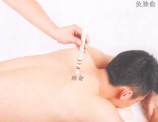多汗症艾灸
