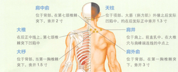 落枕艾灸