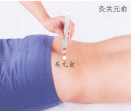 痔疮艾灸