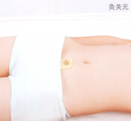 慢性盆腔炎艾灸