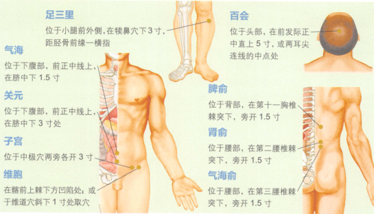 子宫脱垂艾灸