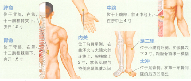 妊娠呕吐艾灸
