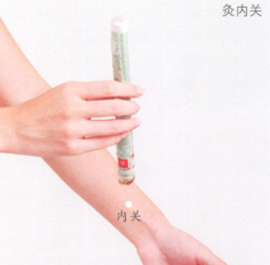妊娠呕吐艾灸