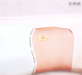 产后腹痛艾灸