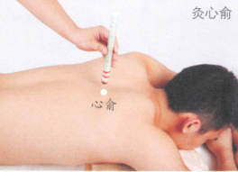 遗精艾灸