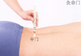 阳痿艾灸