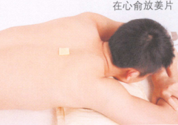 阳痿艾灸