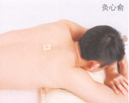 阳痿艾灸