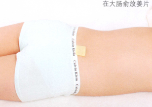 小儿腹泻艾灸