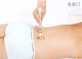 小儿遗尿艾灸