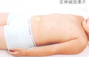 小儿遗尿艾灸