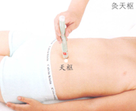 小儿疳积艾灸