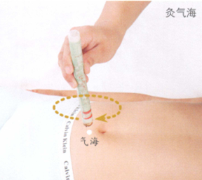 小儿疳积艾灸
