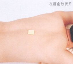 斑秃艾灸