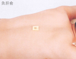 斑秃艾灸
